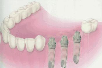 最新武汉垃圾分类消息,武汉垃圾分类怎么样了