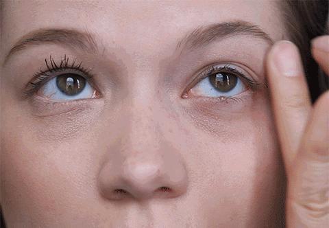 皮秒激光和调q激光哪个先进,皮秒激光消除色素沉着有效吗