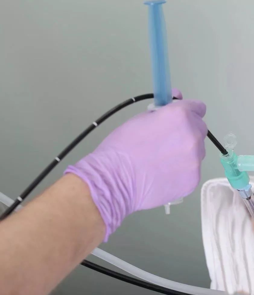 肺泡灌洗液和痰培养的区别,支气管冲洗物与肺泡灌洗液的区别