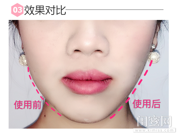 不开刀的“微整形”你值得拥有,ReFaCARATRAYFACE评测功课