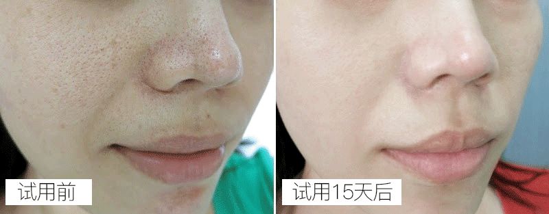 教你这样洗脸,洗脸虽简单也得好好对待