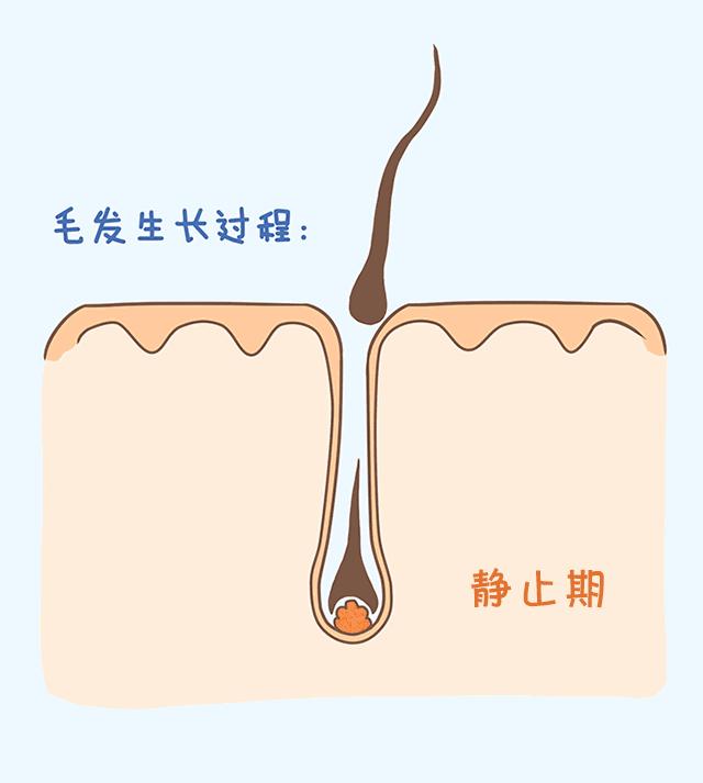 掉多少根头发才算脱发,一天掉多少根头发叫脱发