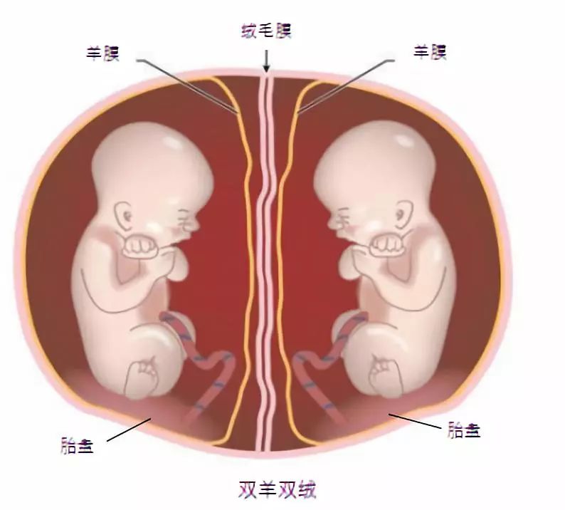 40岁生双胞胎的风险,双胞胎风险真的很大吗