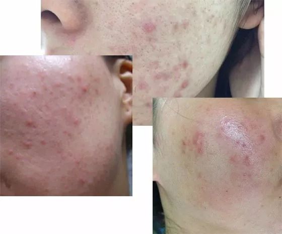 不用吹风机吹头发也可以变干,洗完头怎么不用吹风机弄干头发