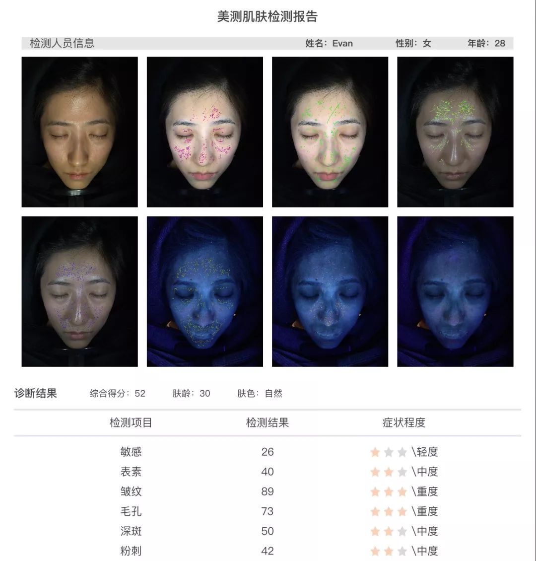 灏忚寕鑲岃瘖瀹ゅ埌搴曟湁澶氬己,灏忚寕鑲岃瘖瀹よˉ姘村悧