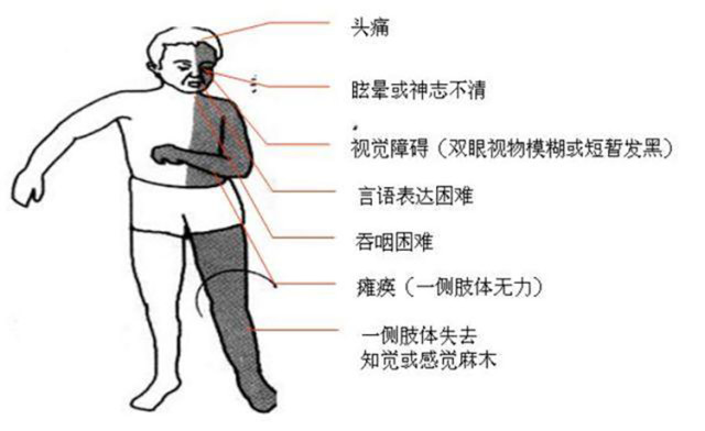 突发肢体抽搐原因待查,全身抽搐发麻呼吸急促怎么解决