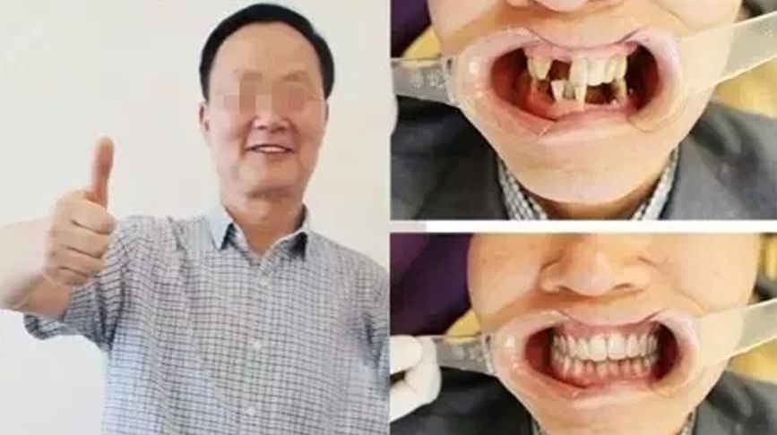 速看！11月起，这些新规实施，矫正牙齿、种植牙这些费用全免！