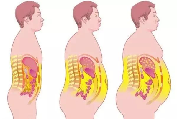 超级靠谱减大肚子内脏脂肪,产后大肚子怎么减内脏脂肪