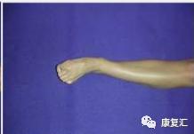 脚踝扭伤很痛怎么医,脚踝内侧筋痛扭伤详细康复训练