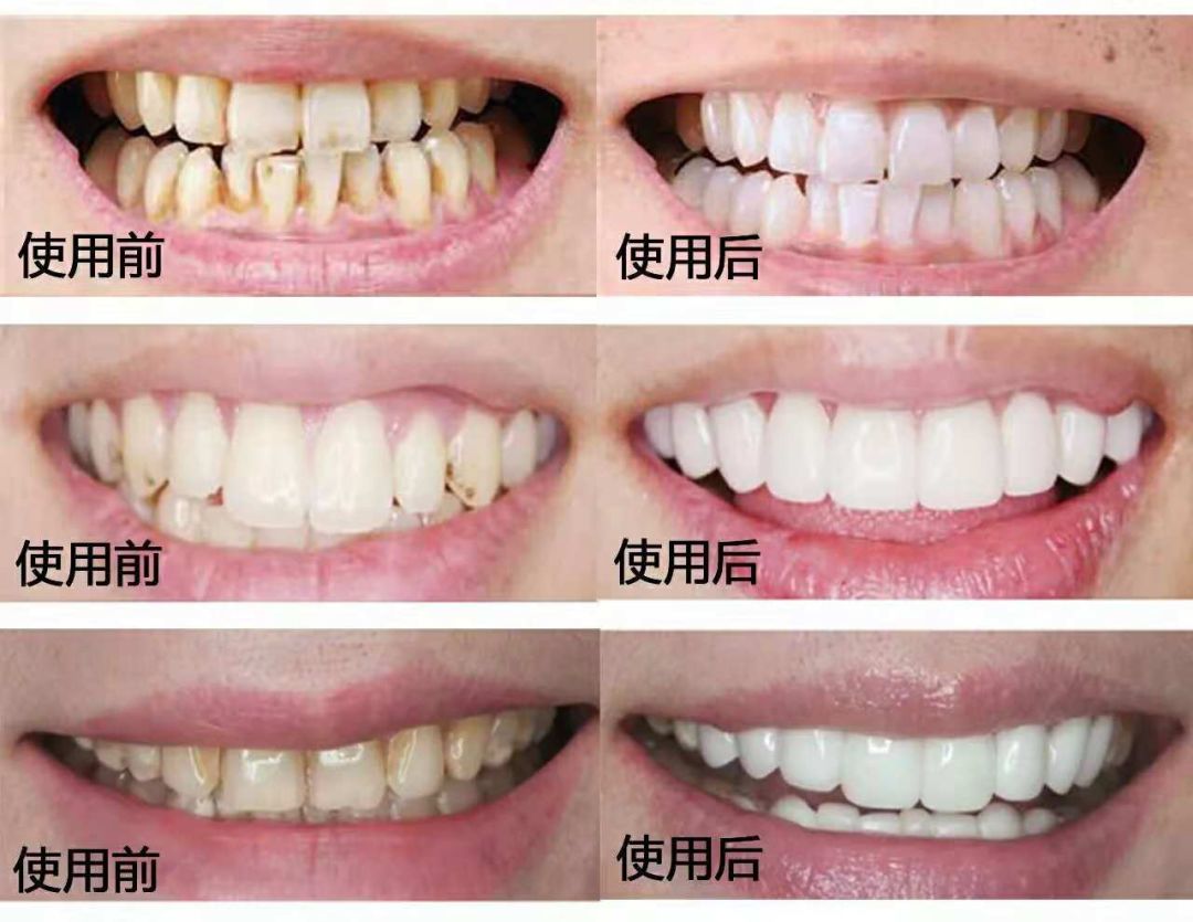 十大美白牙齿牙膏,美白去渍牙膏澳洲