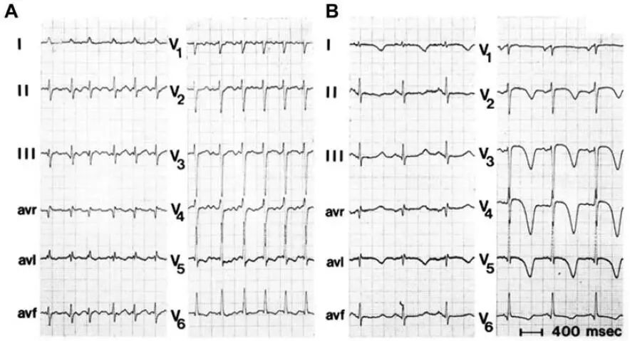 吵架后胸痛呼吸不畅,吵架后胸突然疼痛怎么回事