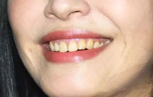 俄罗斯牙膏去黄牙怎么样,祛牙垢黄牙的牙膏国货之光