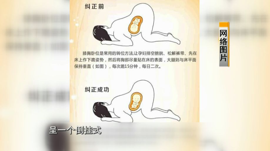 孕妇9个月在做瑜伽突然羊水破了,孕期练瑜伽危险吗