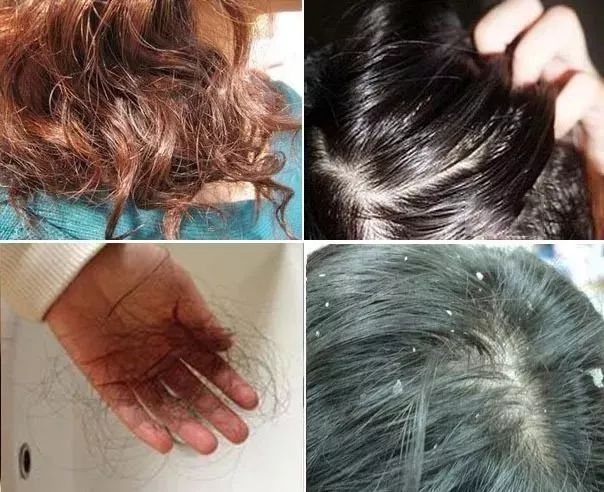 氨基酸洗发水推荐清爽控油,控油强韧发根氨基酸洗发水推荐