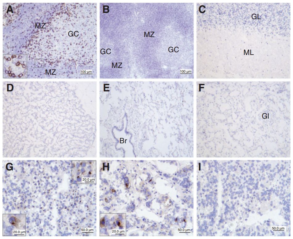 深度解密：PD-1战国时代，如何从单抗的结构和临床前药物特征，评价PD-1单抗的整体性能