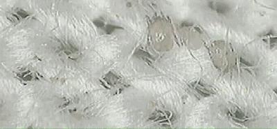 被窝除螨虫最好的办法,教你1分钟清除99%的螨虫