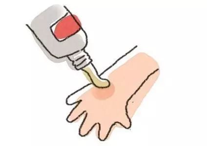 小猫被烫伤了涂什么药,孩子被开水烫伤擦什么