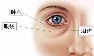 千万别把眼袋当卧蚕,倪海厦中医讲堂说眼袋