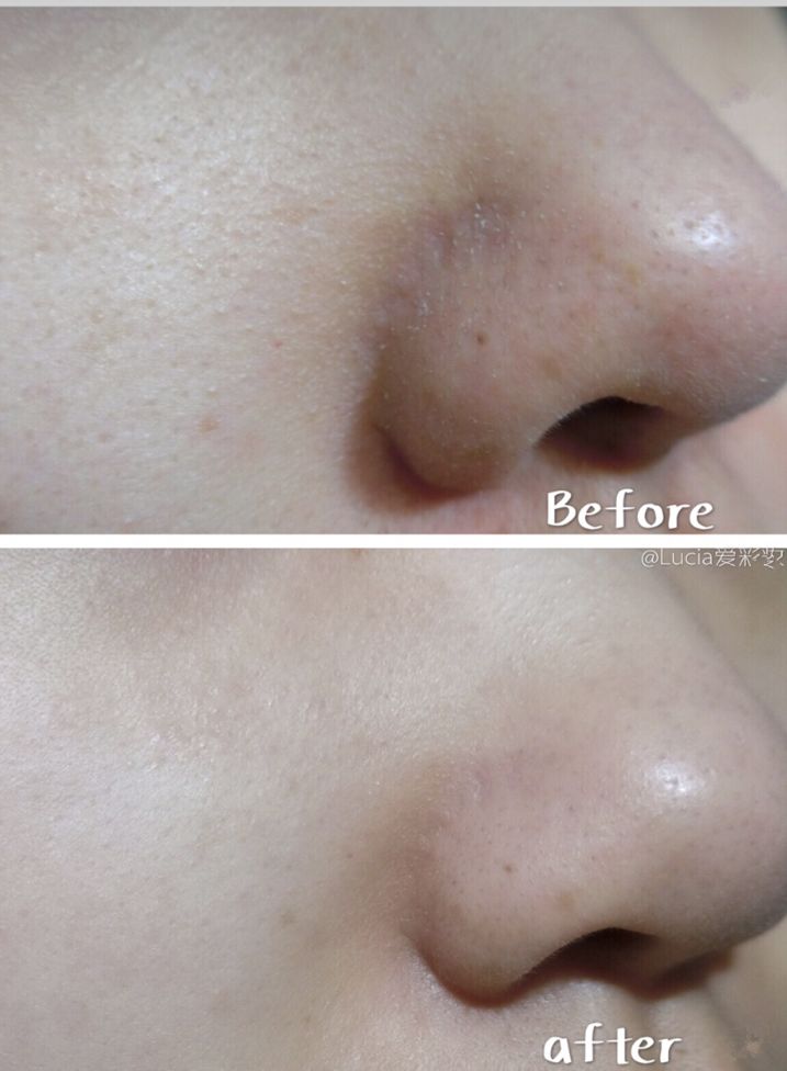 luna平价替代品,平价版的luna