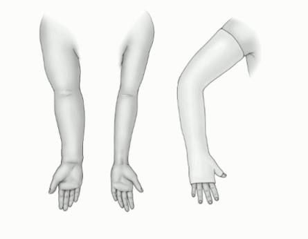 乳腺癌小叶癌手术恢复快,乳腺癌化疗后手肿胳膊肿怎么回事