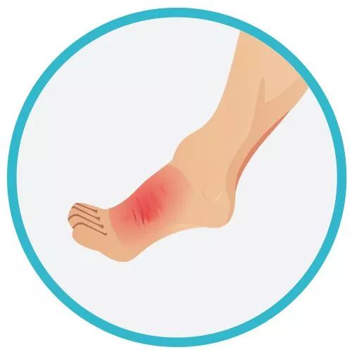 糖尿病足的健康教育与日常护理