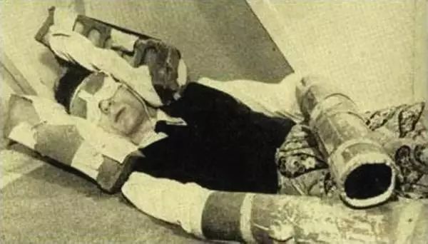 你没听过的西方“黑暗疗法”：竟拯救过1060万病人