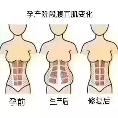 那些妈妈们不知道的产后“尴尬事”