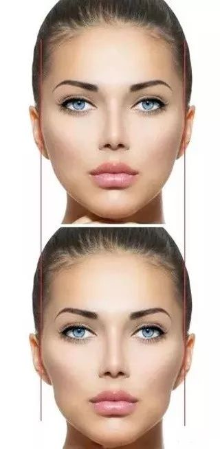 戴牙套整牙的全过程,隐形牙套换头