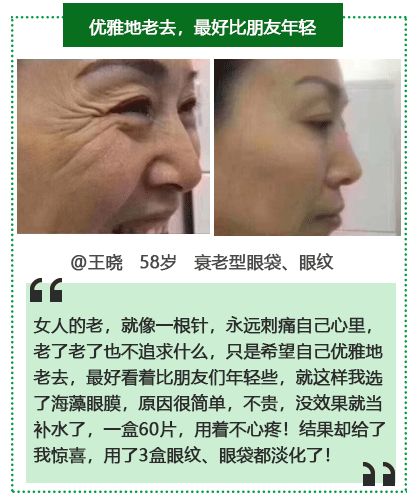 50岁没有眼袋眼纹黑眼圈,60岁去眼袋的最佳方法