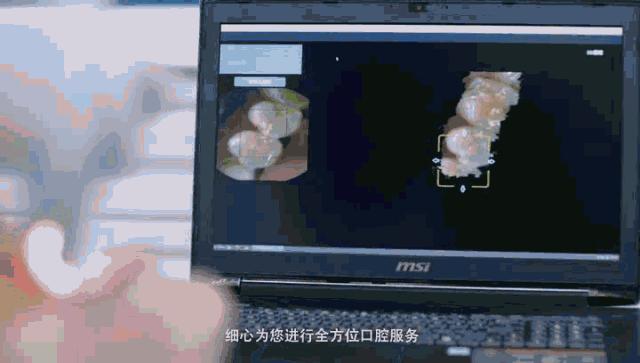 无锡缺牙优惠补贴多少钱,缺牙人士看过来种牙补贴免费领