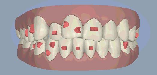 26岁女孩相亲6次没成功,90后女子5次相亲都被拒