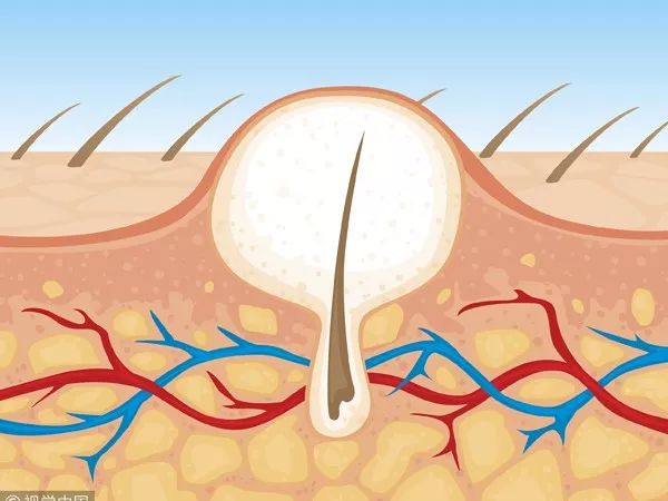 冬日补水面膜推荐,秋冬必备面膜你囤了么