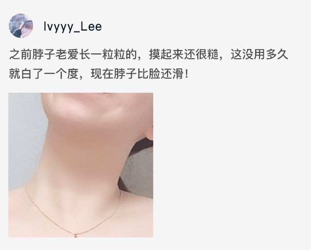 脖子长纹的女人,中年妇女脖子有几圈纹是怎么来的