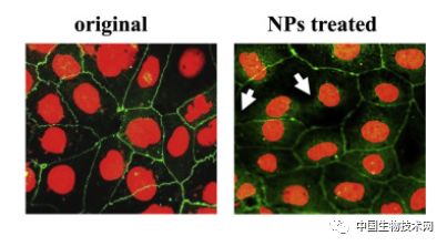 台科大发明自组装纳米粒子，或可实现胰岛素口服给药
