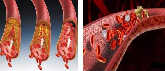 肝功能检查需要提前多久不能进食,肝功能检查前喝了汤