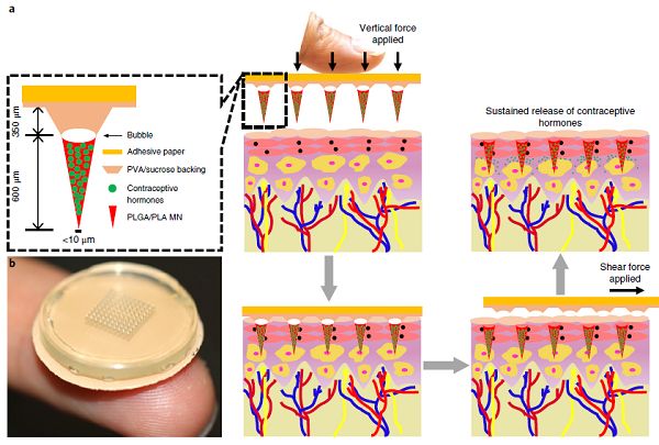 避孕帽避孕贴片,避孕贴片一片能避孕多久