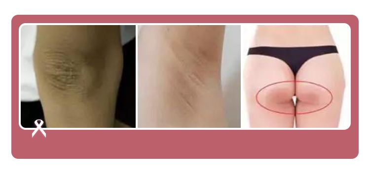 精致从头到脚,细节展现气质,一块嫩红皂让你6周变粉嫩少女!