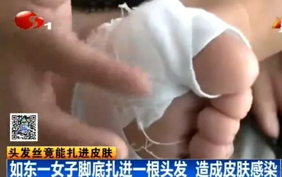 男子理发后被送上断头台,男子理发后昏迷