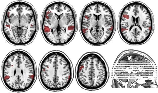 智商都是假象吗,智商是伪命题吗