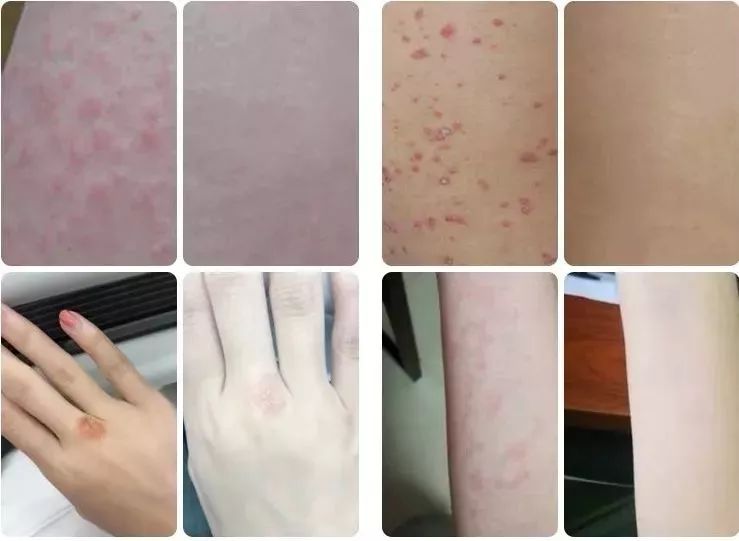 清凉止痒防暑醒神膏,止痒的草药膏