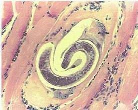 人感染旋毛虫后对人的危害有哪些,提醒别碰几种蔬菜寄生虫多到成堆