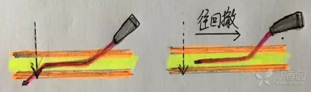 输液刺破血管补救办法,打针刺破血管是如何恢复的