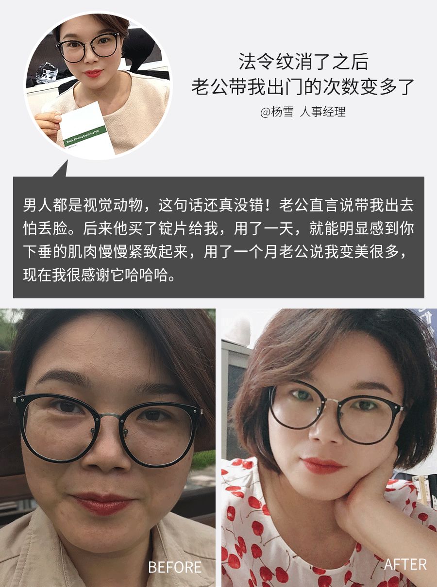 杨紫法令纹填充过多像小猴子,杨紫法令纹和嘴角纹怎么这么深