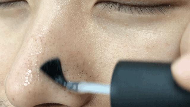 怎么把脸上的黑头清掉,去黑头推荐全脸