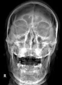 鍕囬棷鐢熷懡绂佸尯鍖婚櫌,鍕囬棷鐢熷懡绂佸尯浜旀鍙仠鎵嬫湳