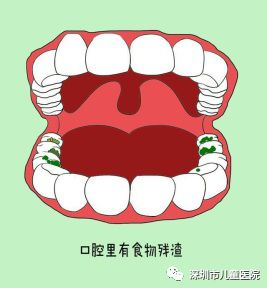 孩子有口臭怎么办最有效的办法,小孩口臭怎么解决有效方法