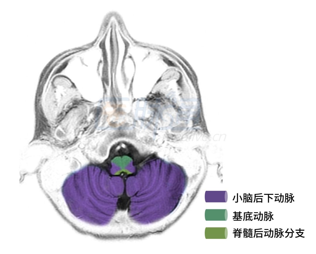 脑动脉供血区域图谱,脑各分支动脉供血区域示意图