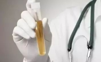 尿隐血2+是什么原因引起的,尿隐血怎么注意饮食