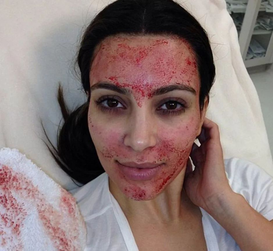 换血养生,换血排毒