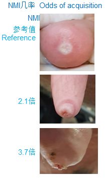 奶牛乳房防冻罩有做的吗,奶牛维护